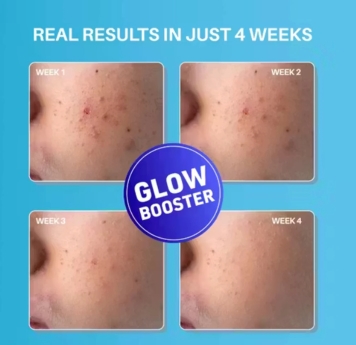 Dermdoc benzea 2% Kojic Acid Night Cream - Image 2