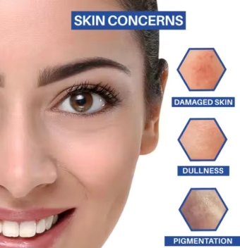 Dermdoc benzea 2% Kojic Acid Night Cream - Image 4